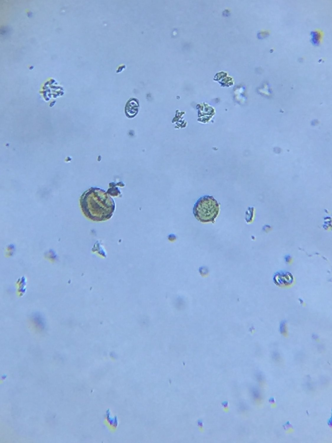 Are These Coccidia Eggs Backyardherds Goats Horses Sheep Pigs