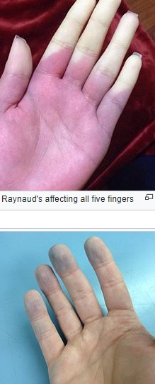 reynauds.jpg