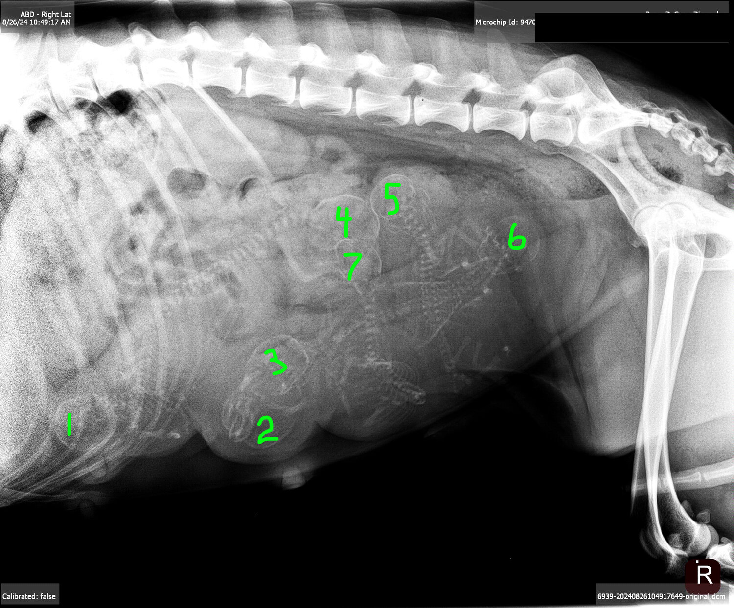 RuseeDeCoeurDeroudur_xray-8-26-24count.jpg